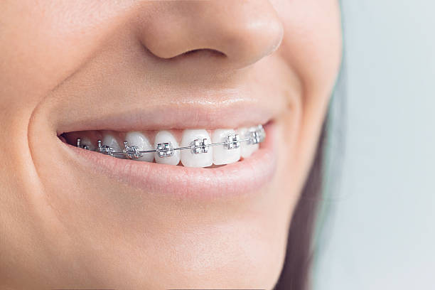 Trusted New London, TX Dental Services Experts